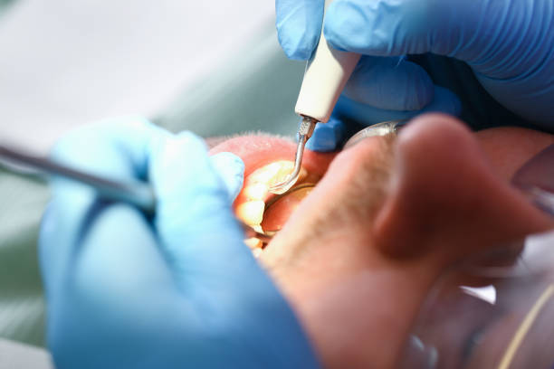 Best Emergency Care for Gum Disease in Gouldtown, NJ